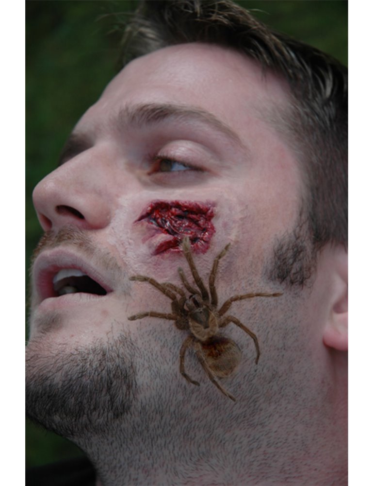 Prosthetic Wounds Spider Attack