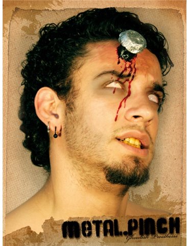 Prosthetic Wound Metal Pinch in Head